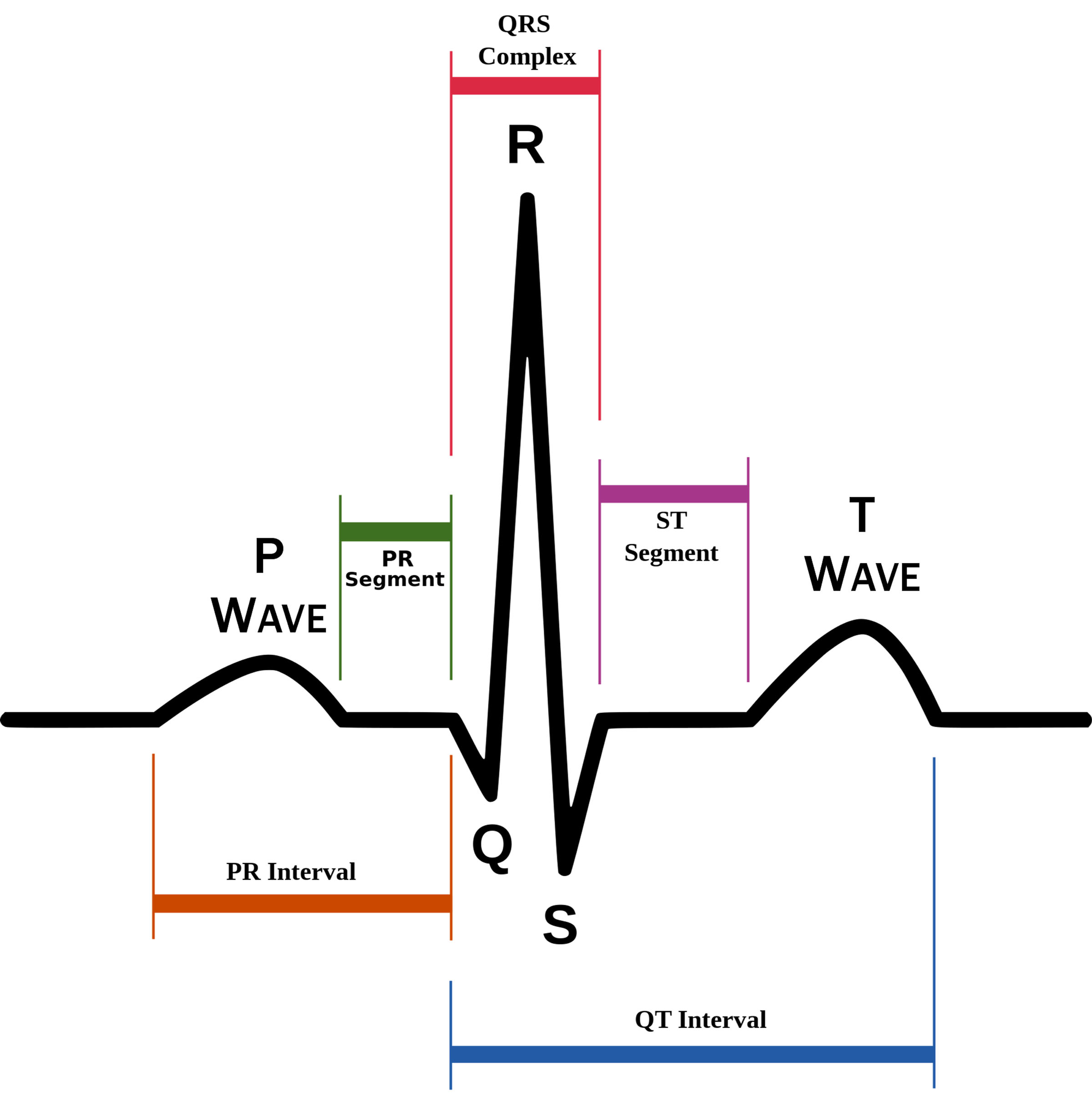 ecg-readout-cscs-study-questions